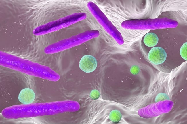 Ученые нашли бактериальную ДНК в эмболах, ставших причиной инсульта