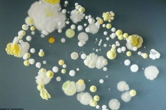 На смартфонах обнаружили опасные бактерии