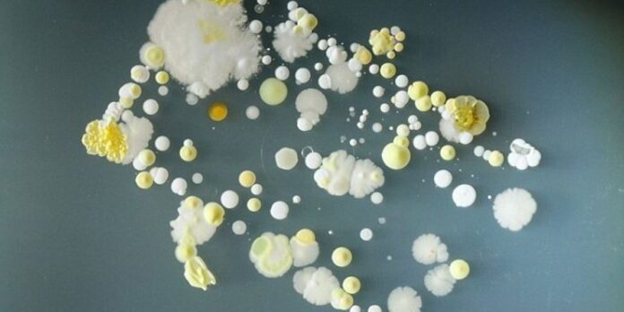 На смартфонах обнаружили опасные бактерии