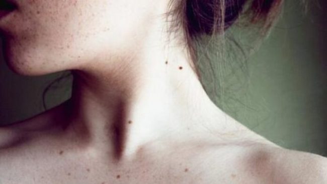 Вредное влияние ультрафиолета: как защитить кожу от рака