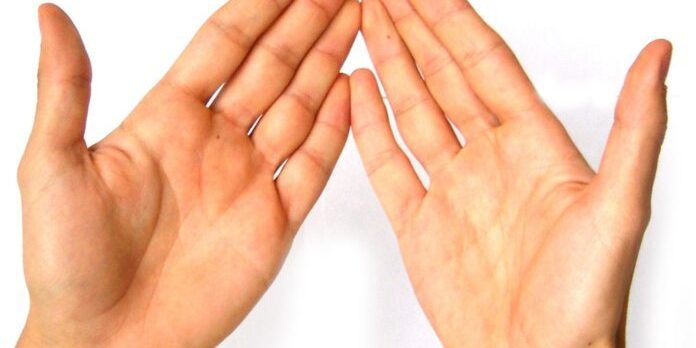 Врач рассказал, можно ли определить рак по рукам