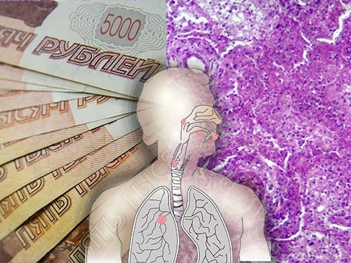 Большинство россиян считает лечение рака легкого слишком дорогим и поэтому малодоступным — МедНовости
