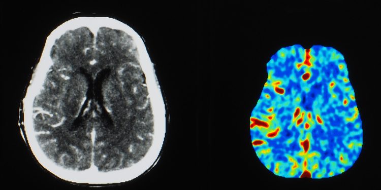 Новый контрастный агент сделает МРТ безопаснее