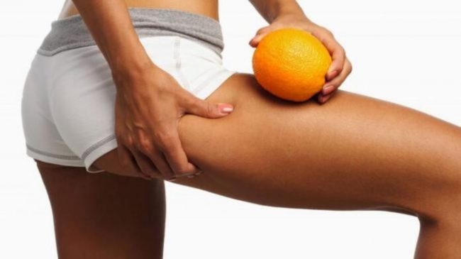 Названы виды пищи, от которых возникает целлюлит