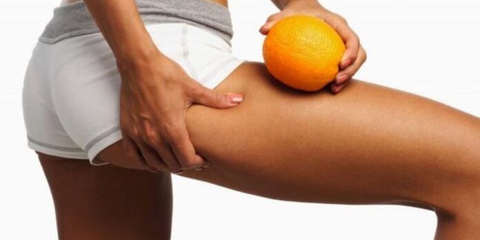 Названы виды пищи, от которых возникает целлюлит