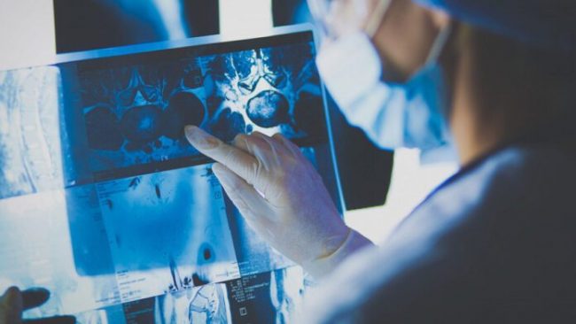 Ученые нашли мощное «живое средство» против рака