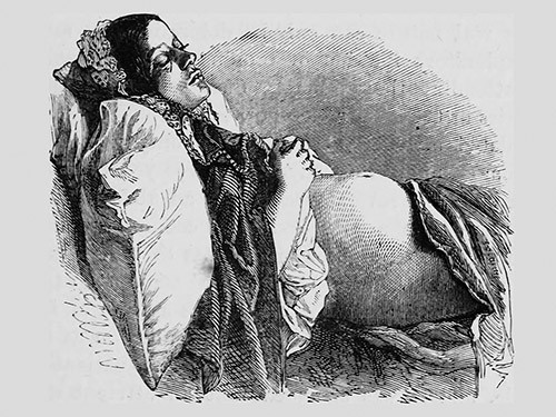 Положение тела во время сна не влияет на исход беременности — МедНовости