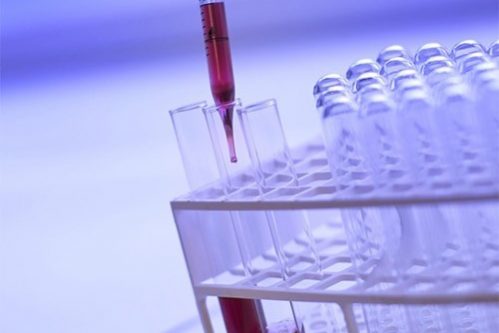 Скрининг может предупредить до половины случаев рака толстой кишки — МедНовости
