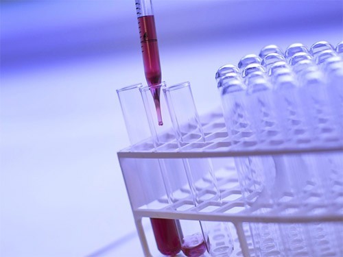 Скрининг может предупредить до половины случаев рака толстой кишки — МедНовости