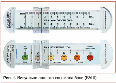 Рис. 1. Визуальноаналоговая шкала боли (ВАШ)