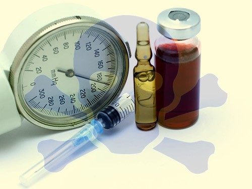 Лечение гипертонии обычно начинают с менее эффективных и более токсичных препаратов — МедНовости