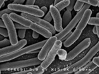 Кишечная палочка захватывает мира из-за людей, не моющих руки