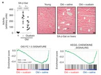 Новый противораковые препарат нашли среди средств для сердечников