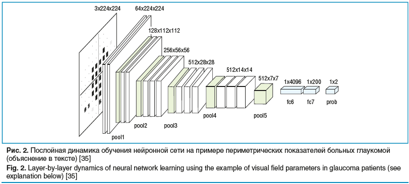 Рис. 2. Послойная динамика обучения нейронной сети на примере периметрических показателей больных глаукомой (объяснение в тексте) [35]