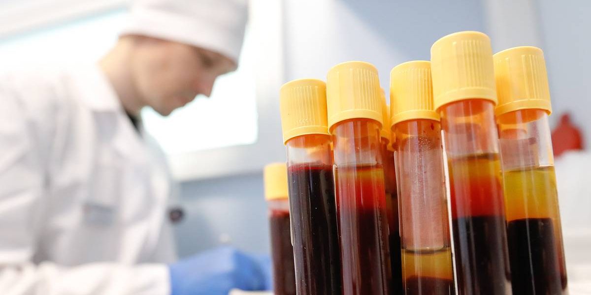 Роспотребнадзор разработал новый подход к генному лечению ВИЧ-инфекций — Общество