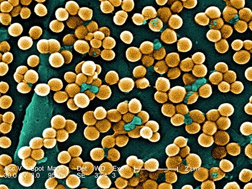 Как стафилококк распространяется по нашим домам — МедНовости