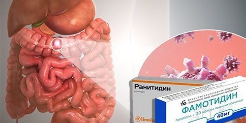 Популярные лекарства против изжоги увеличивают риск гастроэнтерита в 2 раза — МедНовости
