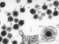 Особый тип герпеса обвинили в провоцировании рассеянного склероза