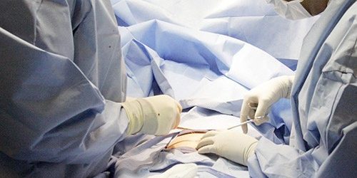 Ежегодно хирурги удаляют тысячи здоровых аппендиксов — МедНовости