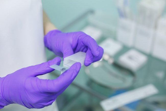 Нерегулярные месячные увеличивают риск рака яичников