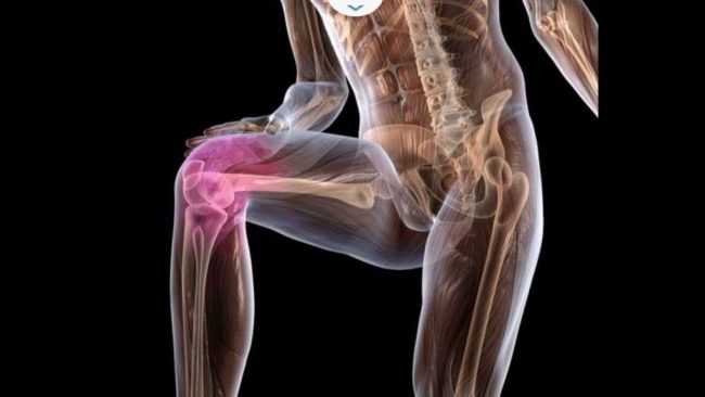 Проблема с суставами: справиться с болью помогут эти четыре способа