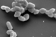 Микрофлора кишечника выявит скрытый колоректальный рак
