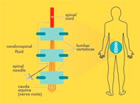 Минздрав обеспечит детей бесплатно одним из самых дорогих лекарств