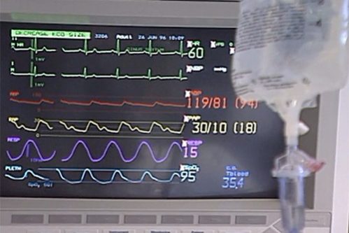 Лечение рака теперь реже приводит к болезням сердца — МедНовости