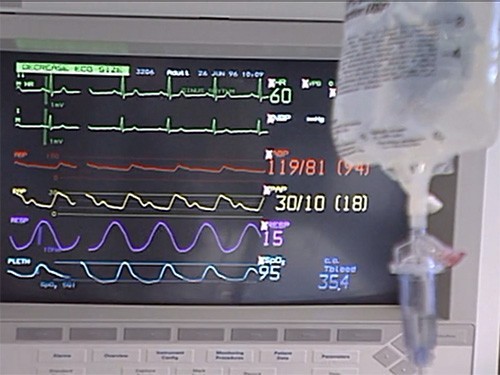 Лечение рака теперь реже приводит к болезням сердца — МедНовости