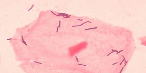 Ученые составили крупнейший каталог вагинальной микробиоты — МедНовости