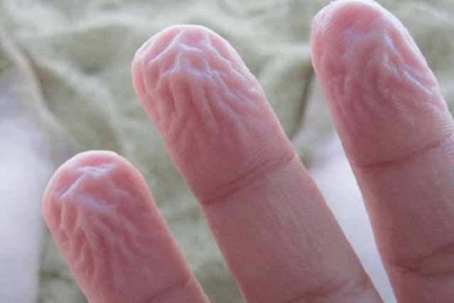 7 странных вещей, которые являются защитными механизмами нашего тела