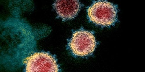 Число жертв коронавируса за сутки — 98, инфицированы 1868 человек — МедНовости
