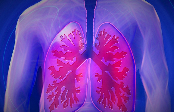 Рак легких: ученые выявили новые признаки смертельной болезни