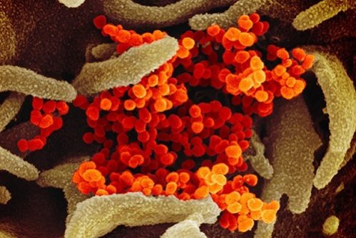 Так выглядит коронавирус под электронным микроскопом — МедНовости