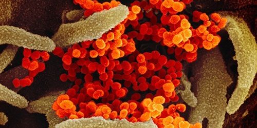 Так выглядит коронавирус под электронным микроскопом — МедНовости