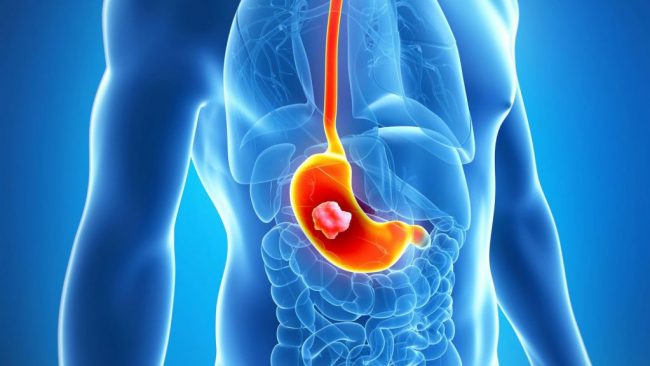 Эти рецепты помогут наладить ваше пищеварение