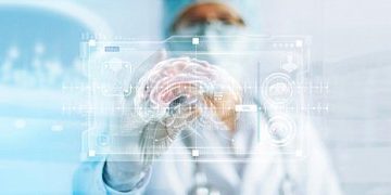 Клинический случай хирургического лечения аномалии Арнольда — Киари с персистирующей фибрилляцией предсердий | Гилемханова И.М., Сафин Ш.М., Деревянко Х.П.