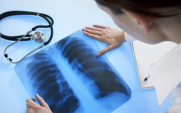 Отечественные специалисты создали уникальные ингаляторы для легочных пациентов