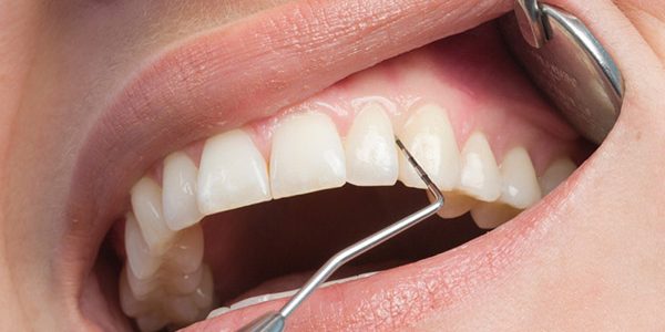 Что есть, чтобы иметь здоровые десна и зубы