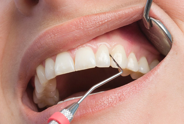 Что есть, чтобы иметь здоровые десна и зубы