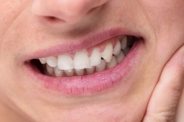 Заболевания, на которые указывает цвет зубного налёта