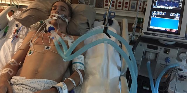 Ученые нашли четкую связь между COVID-19 и тяжелым неврологическим нарушением