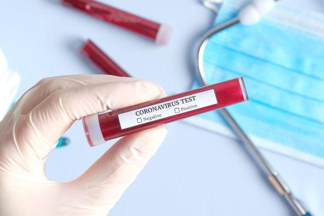 Ученые узнали, когда риск заболеть коронавирусом наиболее высок