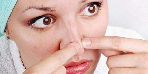 9 натуральных средств в помощь при угревой сыпи
