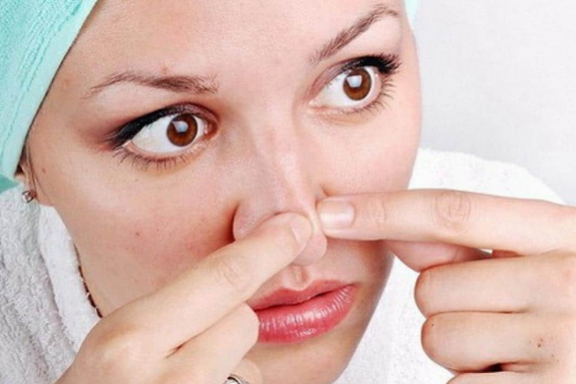 9 натуральных средств в помощь при угревой сыпи