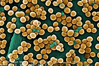 Биологи нашли слабое место у супербактерии золотистого стафилококка