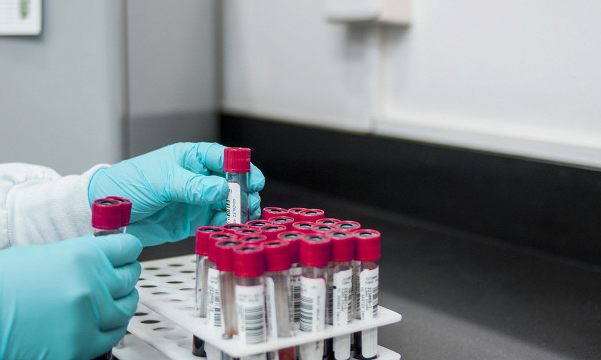 Найден подавляющий за двое суток коронавирус препарат