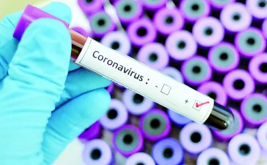 Сильный кашель — характерный признак коронавируса