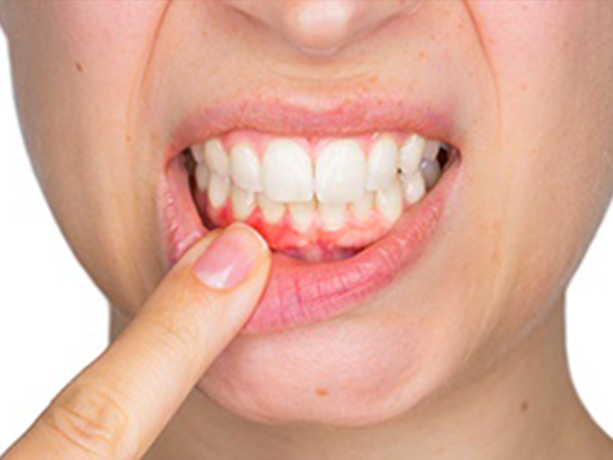 Средства народной медицины при стоматологических заболеваниях