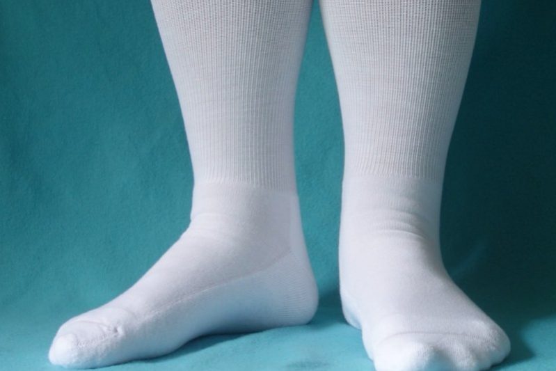 Компрессионные чулки после операции оказались не нужны